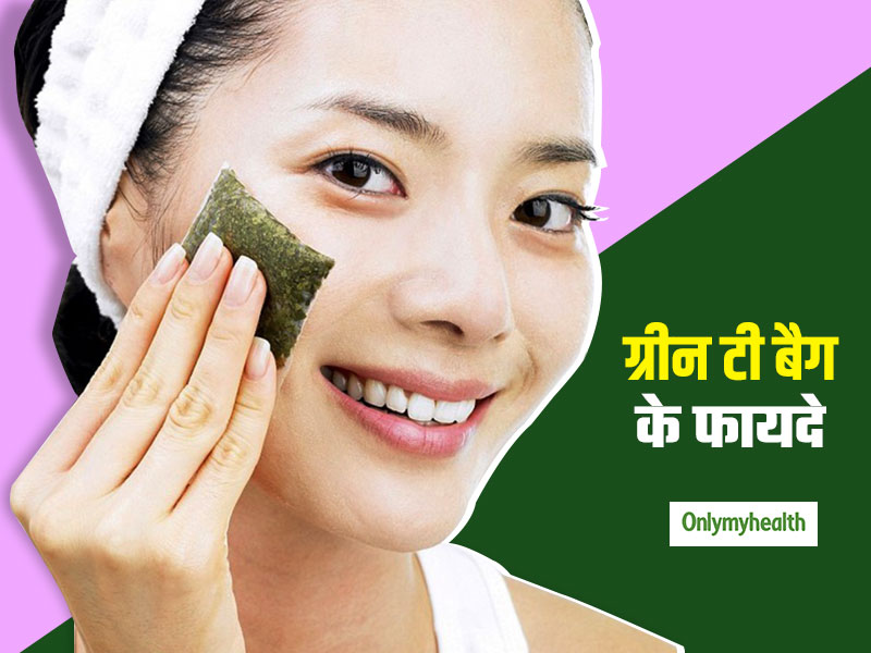 ग्रीन टी बैग के दोबारा इस्तेमाल से ठीक हो जाते हैं चेहरे के मुंहासे और दाग-धब्बे, जानें प्रयोग का तरीका